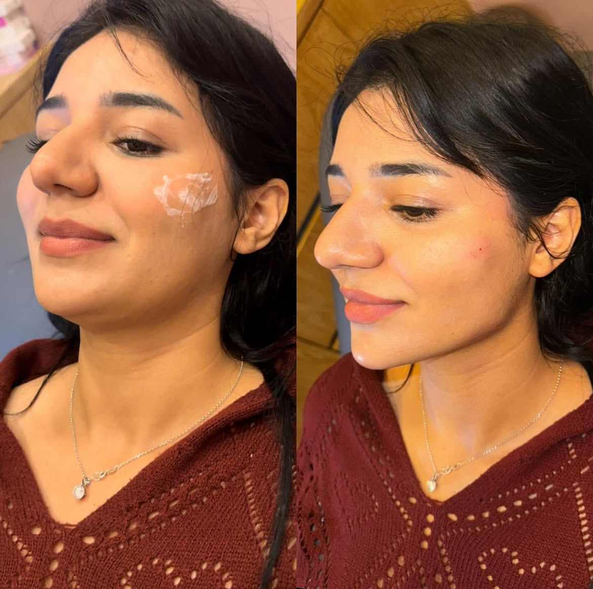 Facial enhancement result